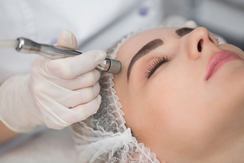 Microdermabrasion-caloundra-sunshine-coast